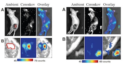 Cerenkov imaging of a glioma xenograft tumor