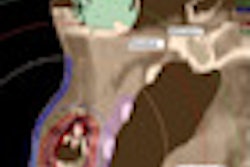 2012 09 06 14 20 53 832 3 Dreconstruction Thumb