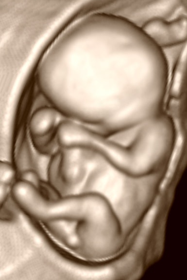 2012 09 15 13 24 56 991 Birnholz3 385