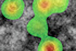2012 09 19 11 01 18 757 Eye Tracking Heatmap Thumb