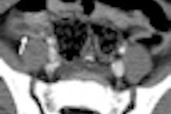 2012 09 26 15 29 41 671 Pediatric Fig 2 Thumb