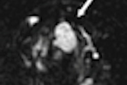 2012 10 02 10 07 36 1 Dce Mri Image A Thumb