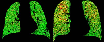 2012 10 08 16 58 56 172 Kazerooni Prm