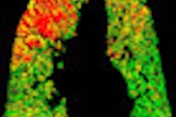 2012 10 08 16 58 56 364 Bottom kazerooni Prm Thumb