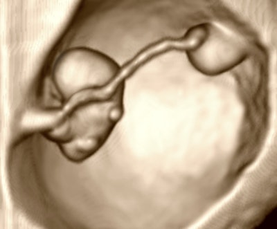 2012 10 18 13 39 18 519 Birnholz3 394