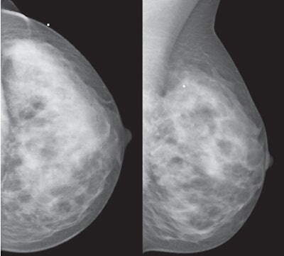 2012 10 19 15 05 47 599 Lehman Figure3 Ab 450