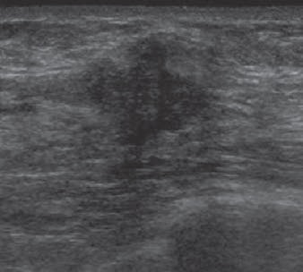 2012 10 19 15 05 49 384 2012 11 Ajr Lehman E