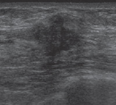 2012 10 19 15 05 49 384 2012 11 Ajr Lehman E