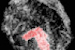 2012 10 23 10 14 43 38 Tomography Thumb
