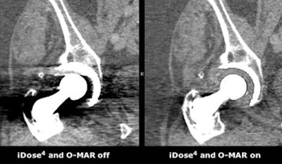 2012 10 23 14 24 14 397 I Dose4 450