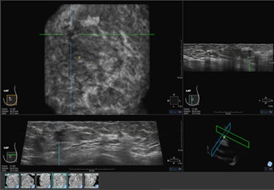 2012 11 09 10 57 48 271 Abus Image 450