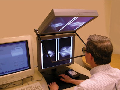Stereoscopic mammography system