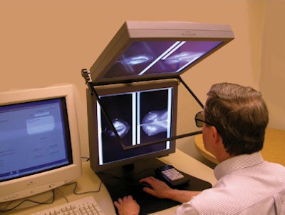 Stereoscopic mammography system