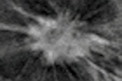 2012 11 20 16 19 08 187 F5 B Rafferty Thumb