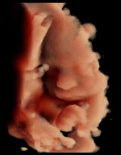 Toshiba's Luminance 4D feature. Image courtesy of Toshiba.