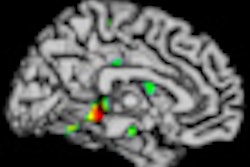 2012 11 25 17 17 59 227 Raji Brain Thumb
