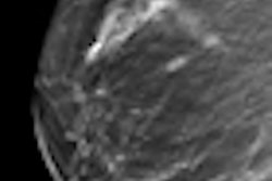 2012 11 27 09 39 34 523 Screening Mammo Haas Thumb