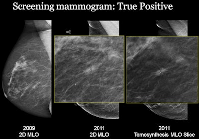 2012 11 27 09 39 36 456 Screening Mammo Haas 450