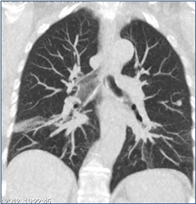 2012 12 13 10 15 08 663 Aalooken mip bottom