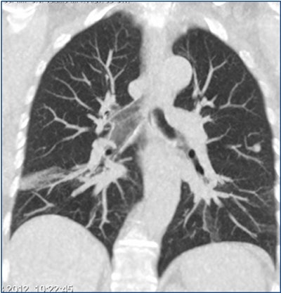 2012 12 13 10 15 08 663 Aalooken mip bottom