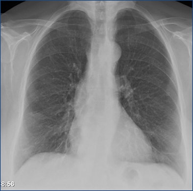 2012 12 13 10 15 09 810 Aalokken xray top