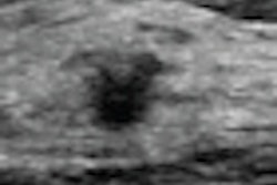 2012 12 03 14 58 46 293 Ibrahim 51 Wbus Thumb