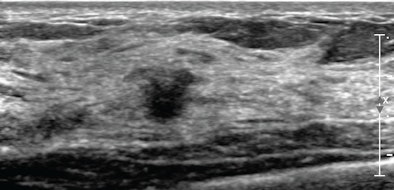 2012 12 03 14 58 47 359 Ibrahim 51 Wbus 450