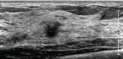 2012 12 03 14 58 47 359 Ibrahim 51 Wbus 450