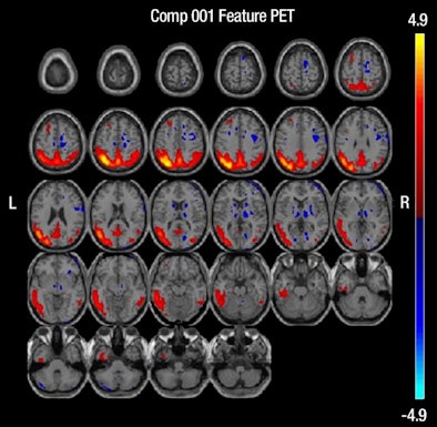 2012 12 11 10 07 11 127 Shaffer Pet Alz 394