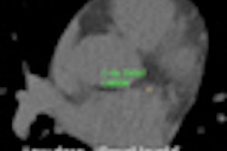 2012 12 14 14 53 58 426 Calciumscore 70
