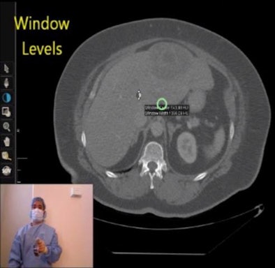 2012 12 19 11 03 04 581 Looppointer 394