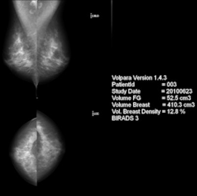 Image with Volpara breast density score. Courtesy of Matakina International.
