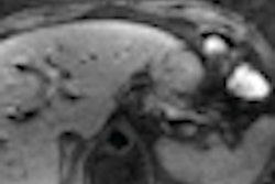 2012 12 26 13 38 31 991 Mikell Astro 3 D Vibe Mri 70