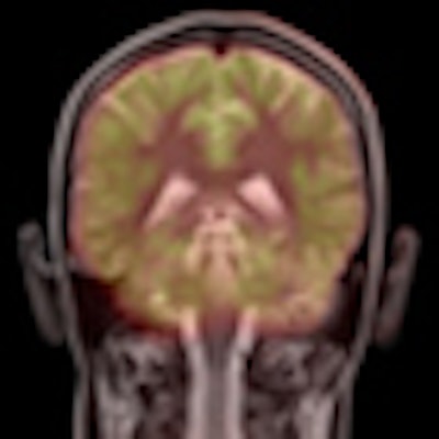 2012 01 25 12 23 38 759 Pet Mri Thumb