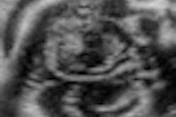 2013 01 03 15 08 31 642 Context Vision Fetal Brain Thumb