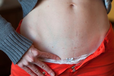 2013 01 03 16 53 33 776 Birnholz3 B 450