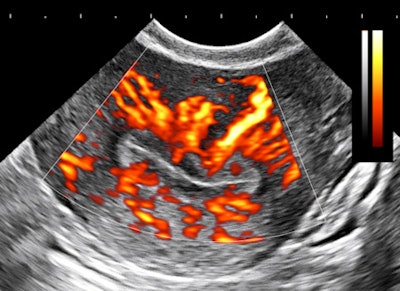 2013 01 03 16 53 37 980 Birnholz2 D 450