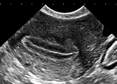 2013 01 03 16 53 40 41 Birnholz2 C 450