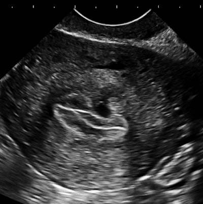 2013 01 03 16 53 42 816 Birnholz2 B 450