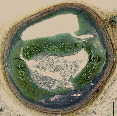 2013 01 08 15 20 41 189 Siefarth Bottom Histology 394