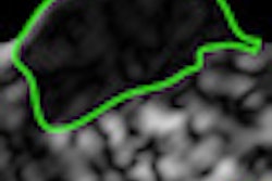 2013 01 09 16 27 05 983 Satish E Thumb