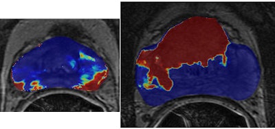 2013 01 09 16 27 11 823 Satish Cand F 450