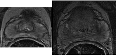 2013 01 09 16 27 13 345 Satish Aand D 450