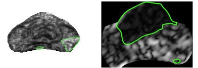 2013 01 09 16 39 31 312 Satish Band E 450