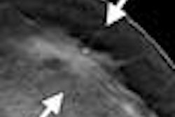 2013 01 15 17 27 28 372 Zuley Fig 3b 394 20130116003325
