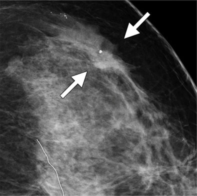 2013 01 15 17 27 29 472 Zuley Fig 3a 394