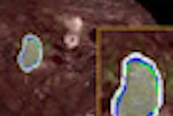 2013 01 18 11 45 13 683 Petmri Bagci Thumb