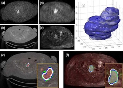 2013 01 18 11 45 15 654 Bagci Slide16 450