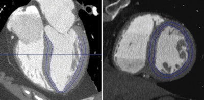 2013 01 28 14 39 21 711 Spiro 1 A 1 B Combined 450