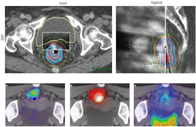 2013 01 30 11 48 12 369 Kumar Petct 450